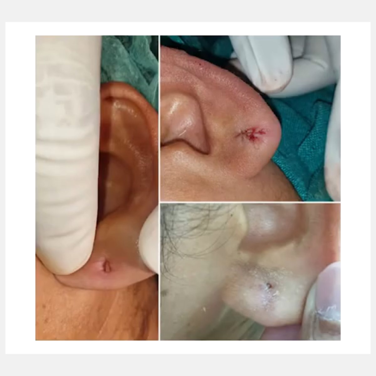 Magic Pulse CO₂ before and after result