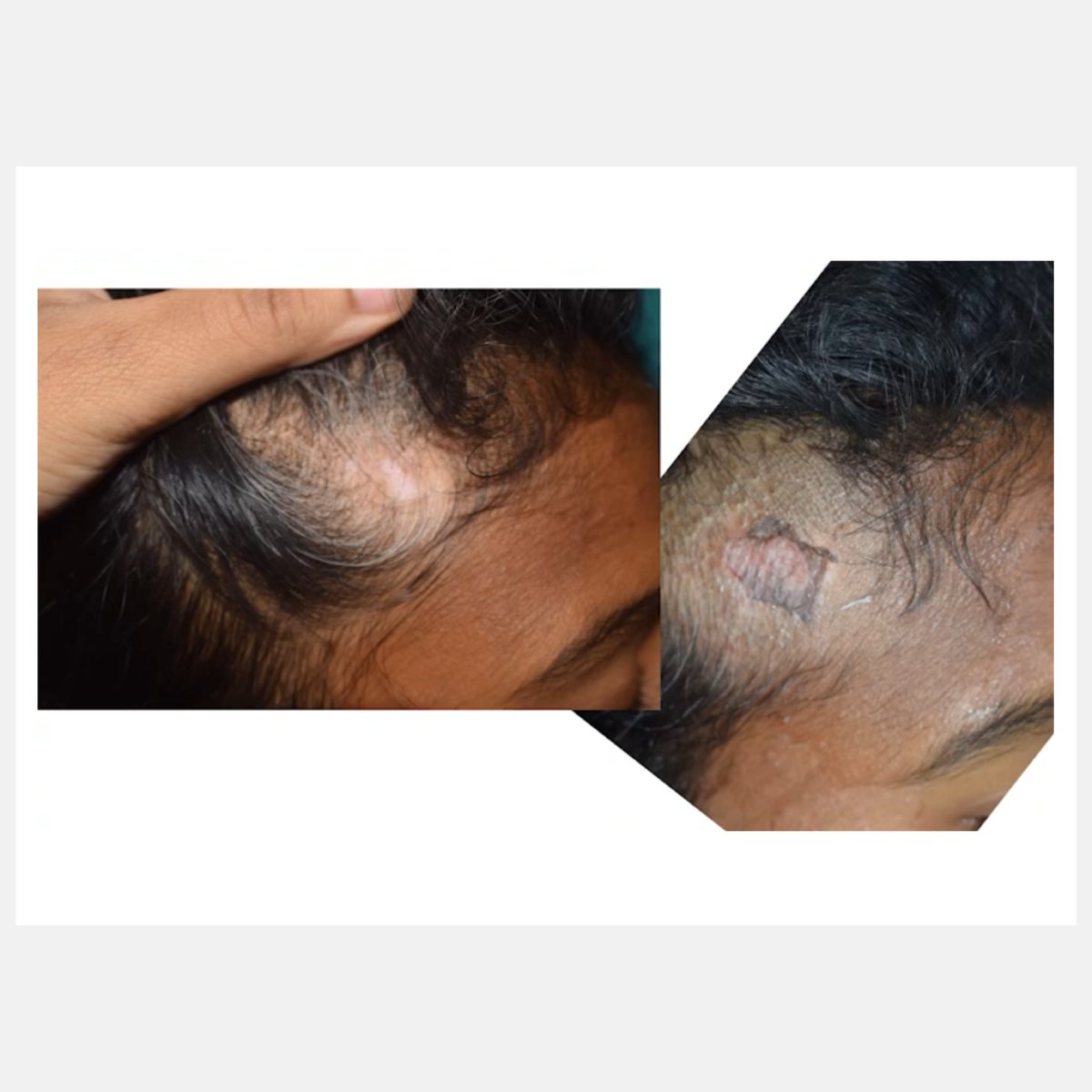 Magic Pulse CO₂ before and after result