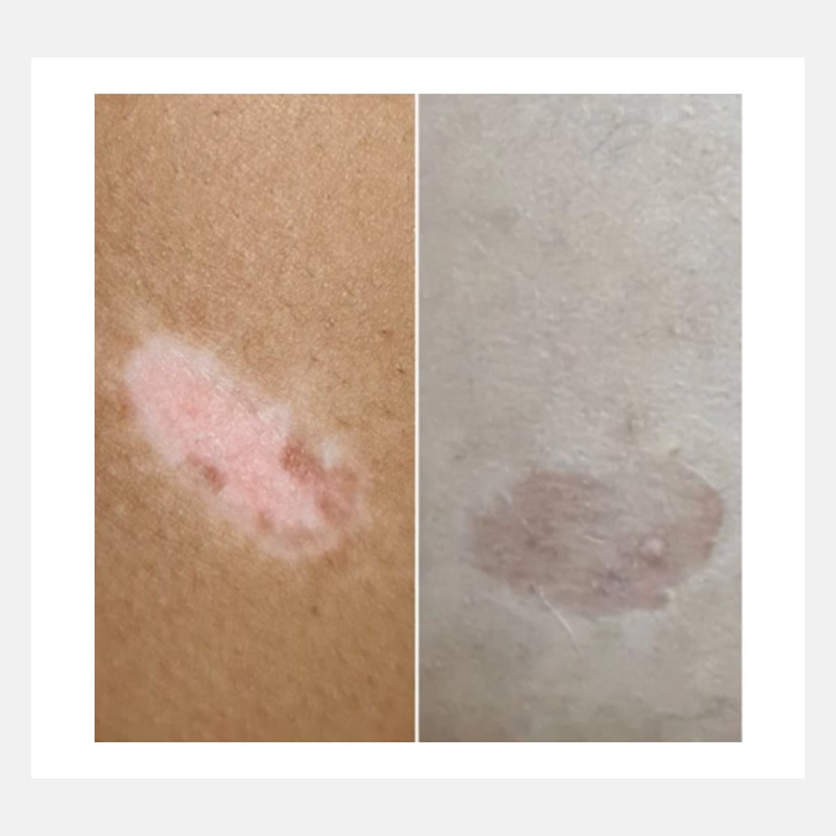 Magic Pulse CO₂ before and after result