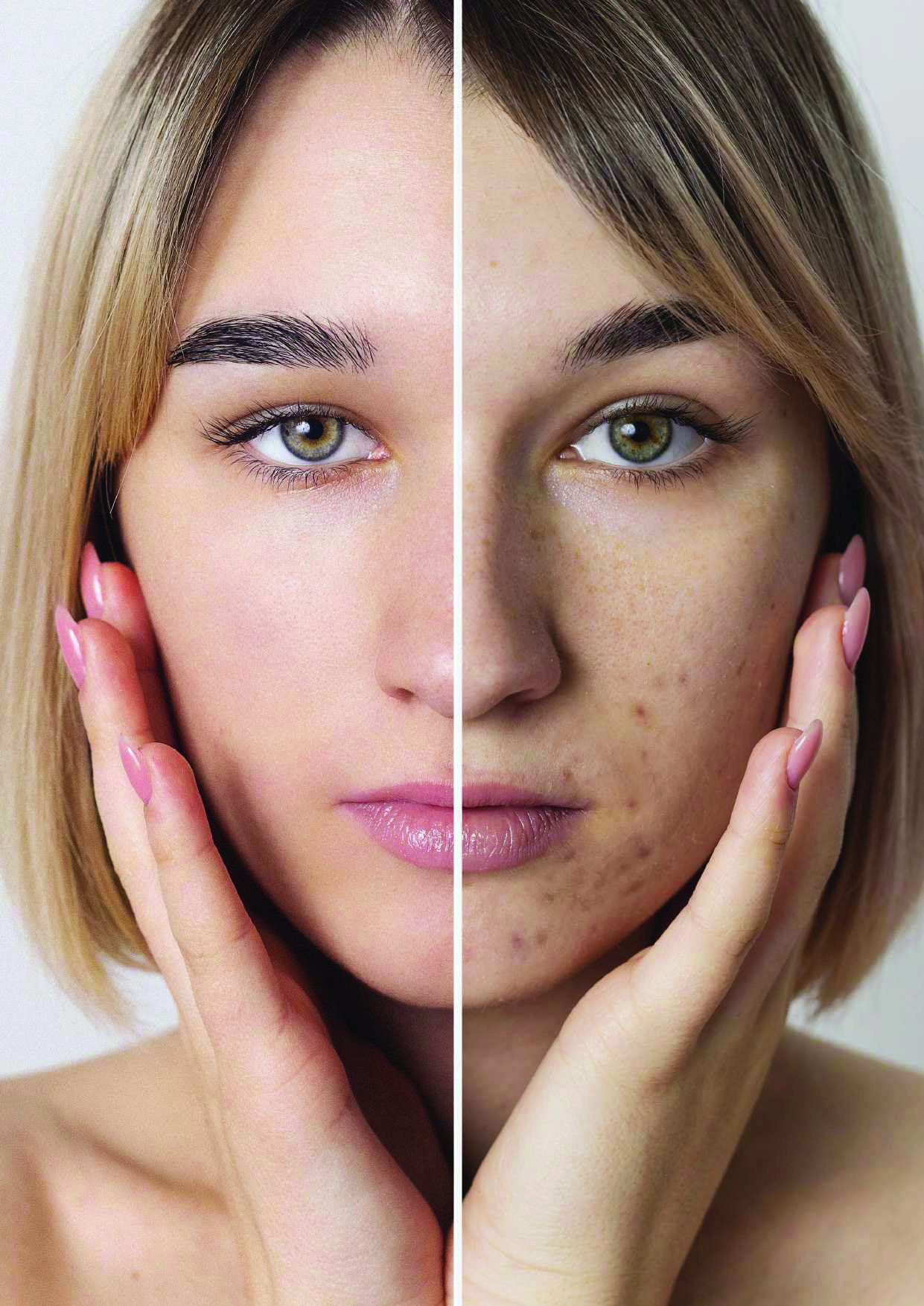 Skin Rejuvenation